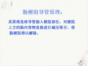 经鼻型肠梗阻导管在造影中的应用PPT课件.pptx