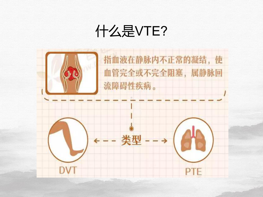 血栓的预防与管理课件整理.pptx_第2页