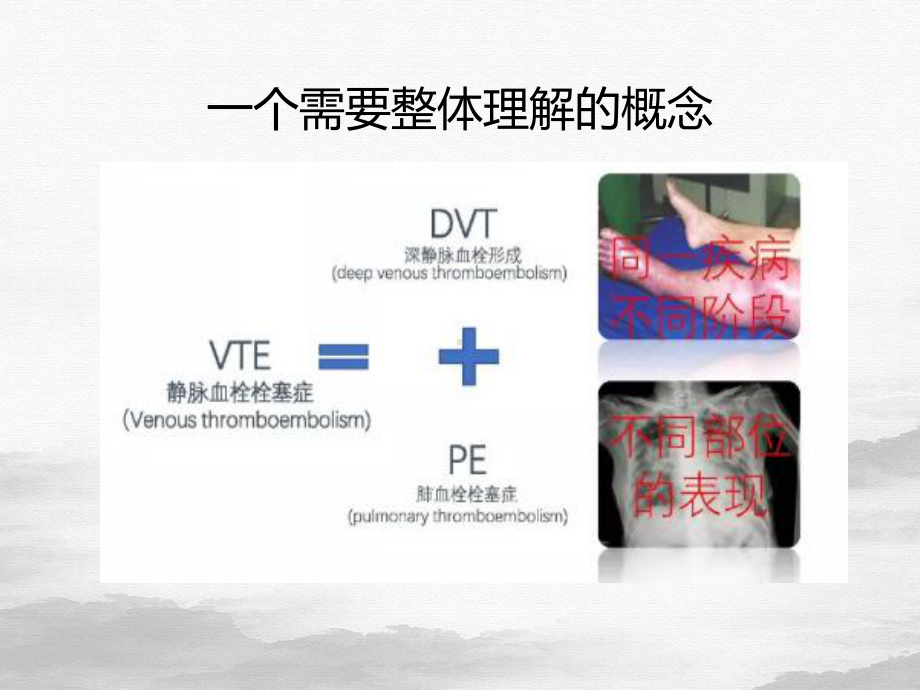 血栓的预防与管理课件整理.pptx_第3页