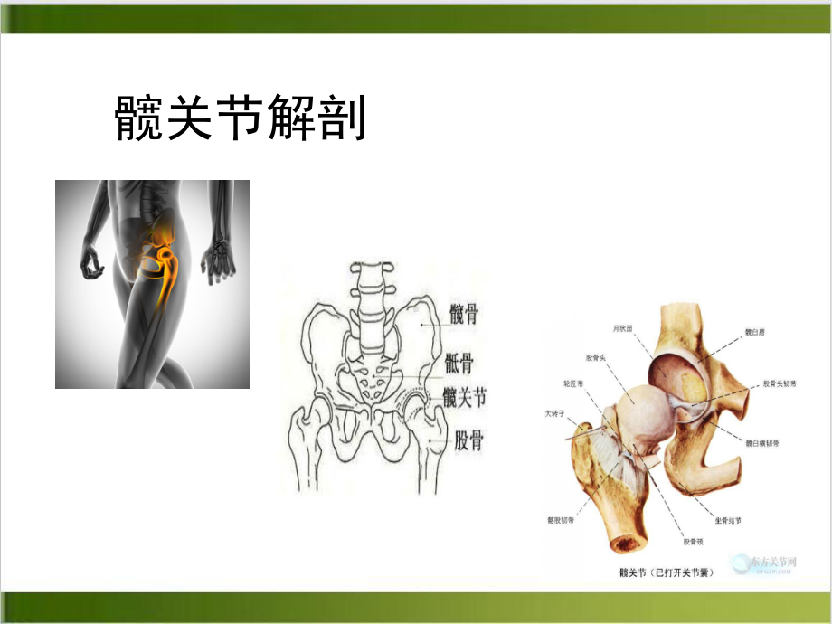 髋关节置换护理查房课件整理.ppt_第3页