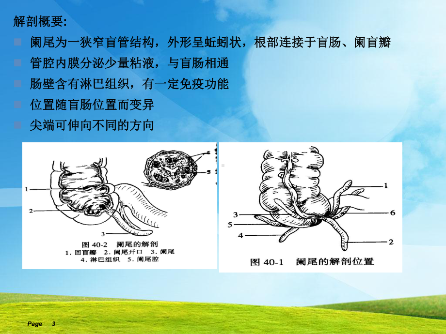 阑尾炎护理查房月课件.pptx_第3页