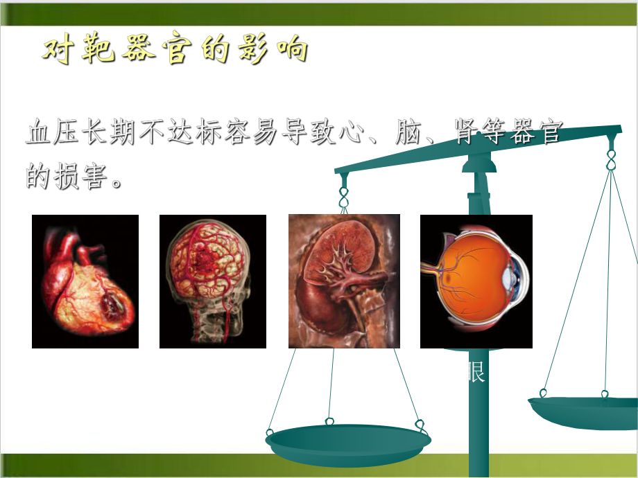 社区高血压综合管理的主要内容和措施课件.pptx_第3页