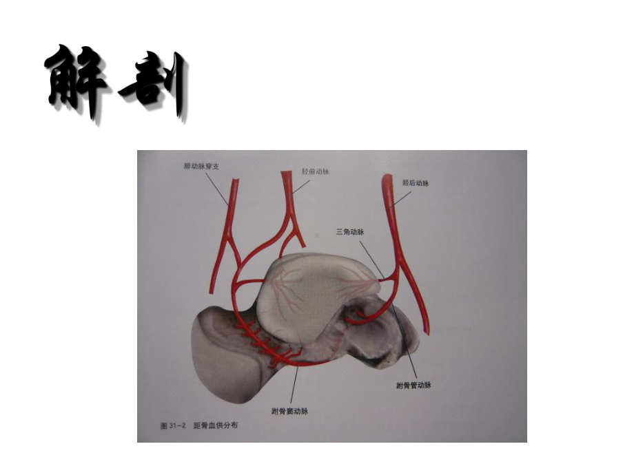 陈旧性距骨hawkinⅲ型骨折处理课件.ppt_第3页