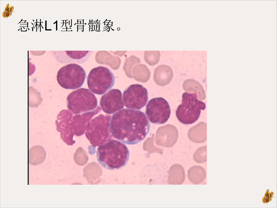 骨髓血液细胞学检查培训课件.pptx_第2页