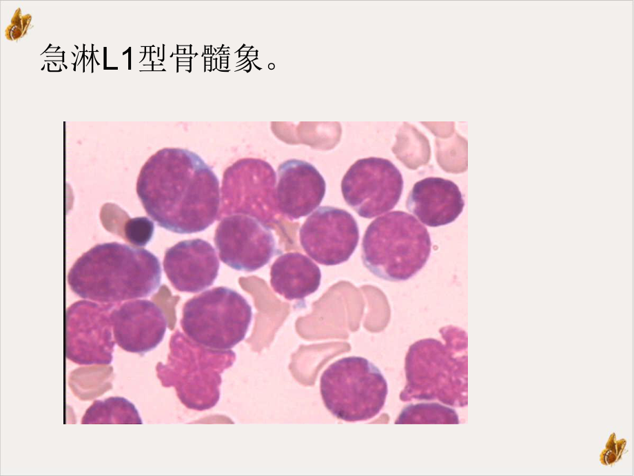 骨髓血液细胞学检查培训课件.pptx_第3页