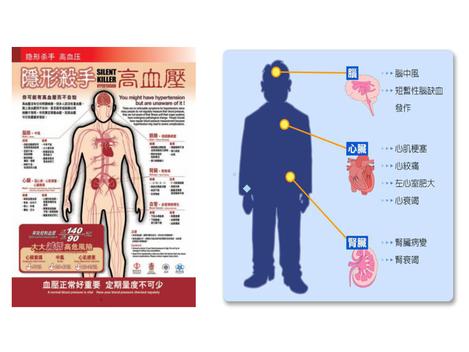 继发性高血压筛查和诊断策略课件.ppt_第3页