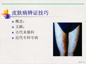 皮肤病辨症技巧优选课件.pptx