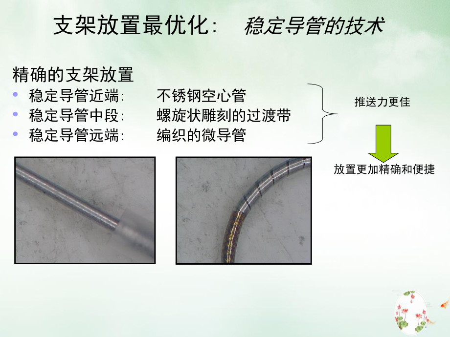 神经介入支架植入术选择课件.ppt_第3页