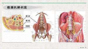 髂腰肌源性腰腿痛治疗优质版课件.pptx