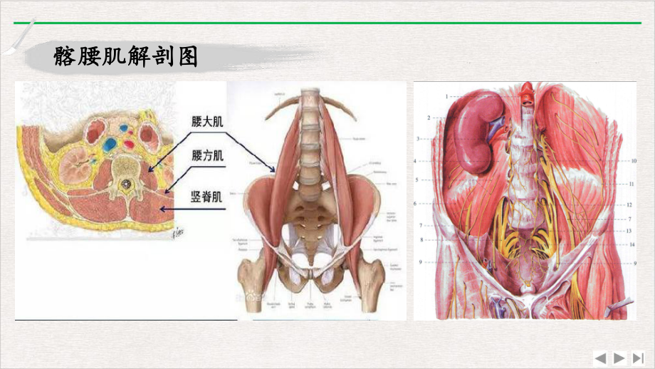 髂腰肌源性腰腿痛治疗优质版课件.pptx_第1页