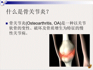 骨关节炎的预防和康复课件.pptx