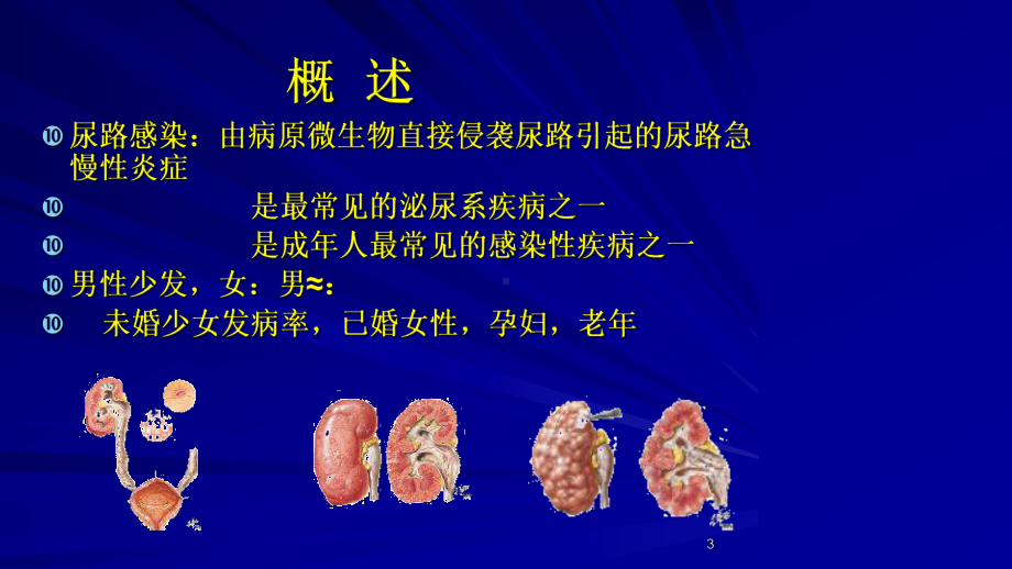 第三节尿路感染病人护理课件.ppt_第3页