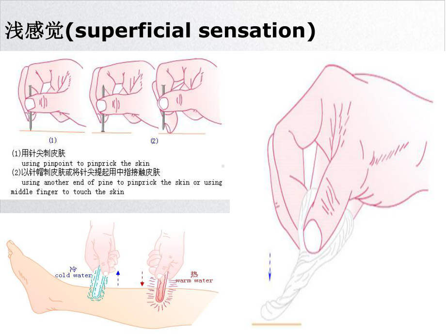 神经系统体格检查感觉运动部分示范课件.ppt_第3页