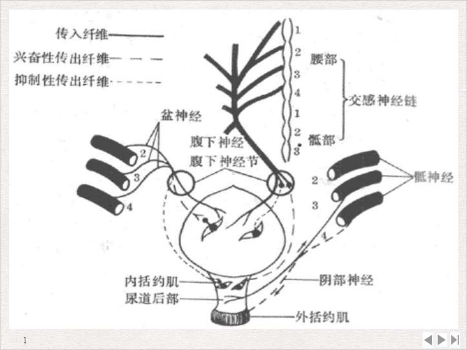 骨折病人术后尿潴留的护理课件.pptx_第3页