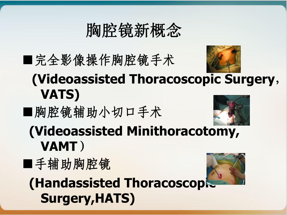 肺叶切除术后护理全肺切除术后护理课件1.ppt_第3页