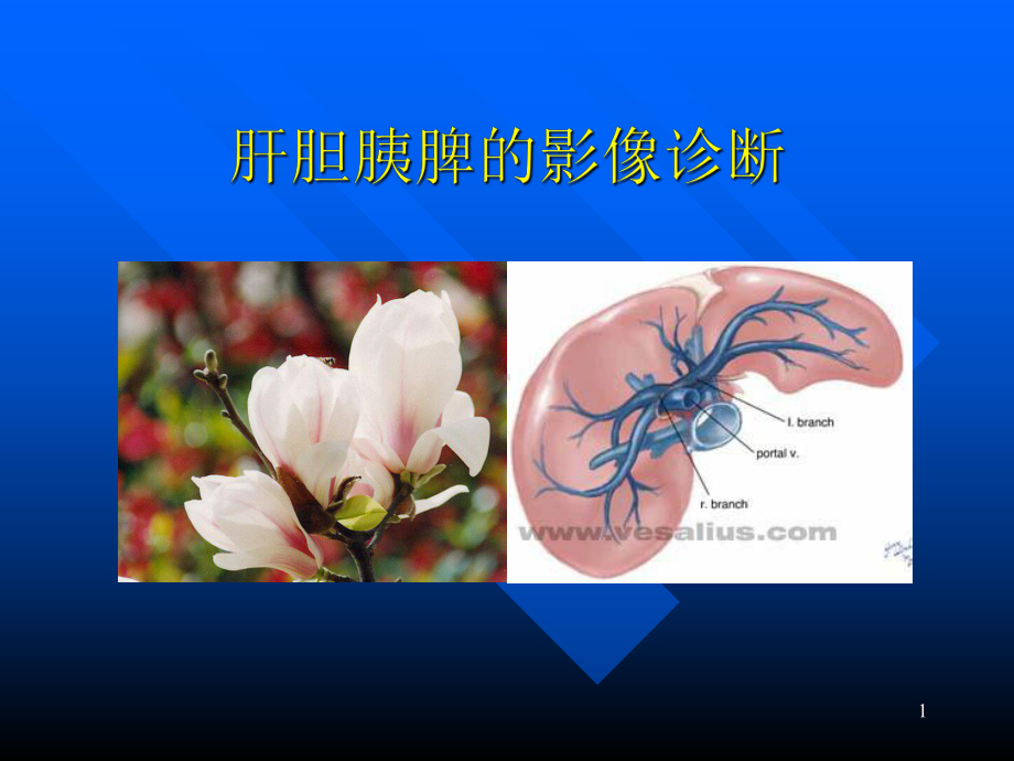 肝胆胰脾的影像诊断课件.ppt_第1页