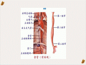 食道癌护理查房课件1.pptx