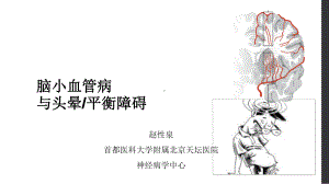 脑小血管病与头晕及平衡障碍课件.ppt