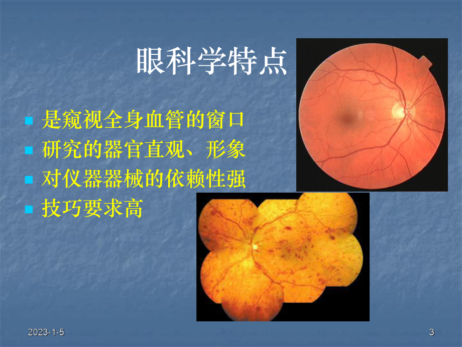 精选眼科学基础PP课件资料.ppt_第3页