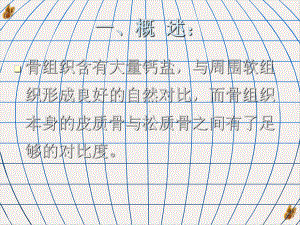 骨关节系统病变影像检查方法选择及基本病变的影像表现培训课件.pptx