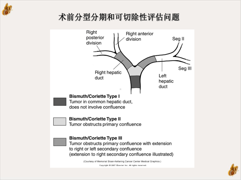 高位胆管癌外科治疗课件.ppt_第3页