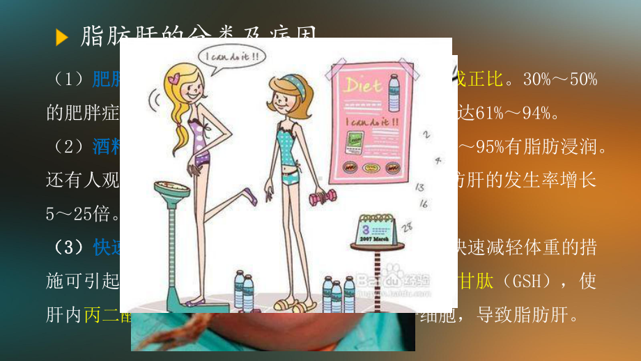 脂肪肝案例分析上课讲义课件.ppt_第2页