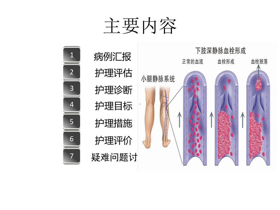 重度颅脑损伤患者并发症护理课件.ppt_第2页