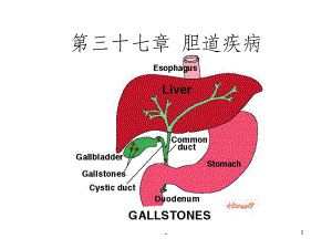 胆道疾病学习课件.ppt