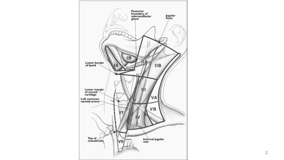 颈部的三角及淋巴结课件.ppt_第2页