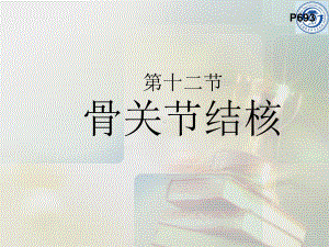 骨关节结核-课件.ppt