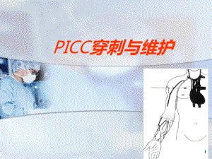 PICC穿刺与维护医学课件.ppt