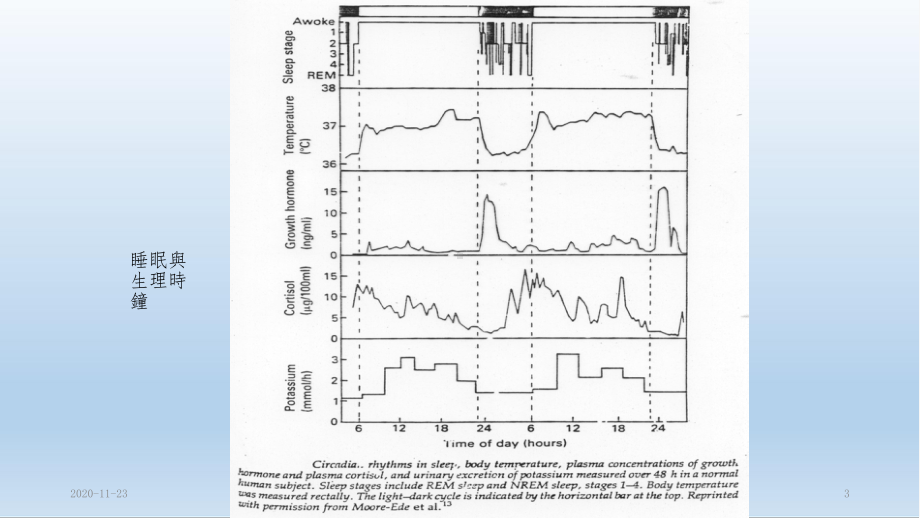 (2020年)常见睡眠障碍(最新课件).ppt_第3页