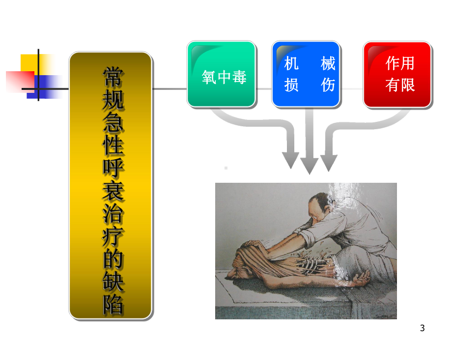 ECMO-概述学习课件.ppt_第3页