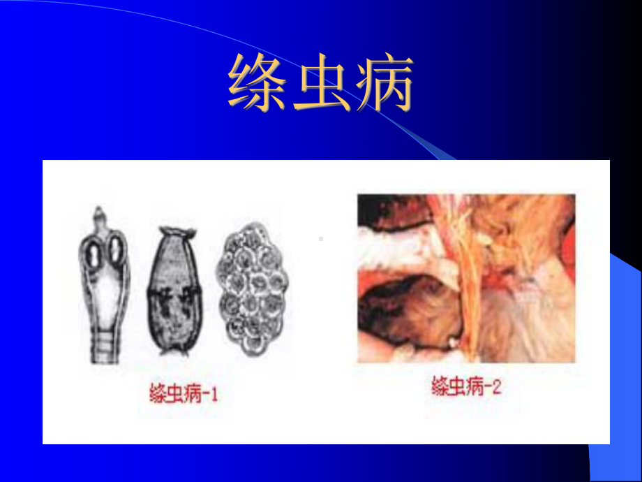 18绦虫病、囊虫病课件.ppt_第2页