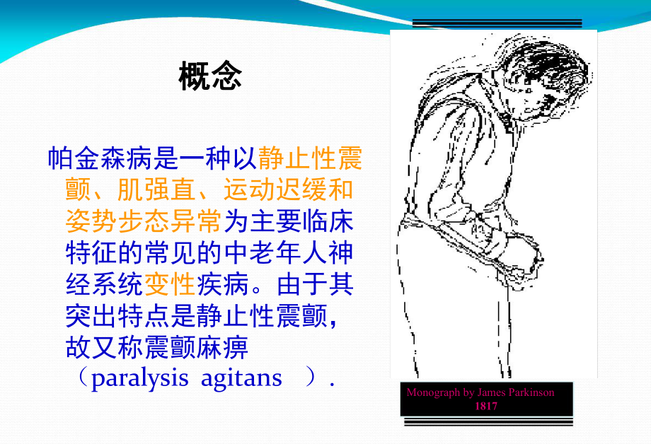 3帕金森病的护理课件.ppt_第3页