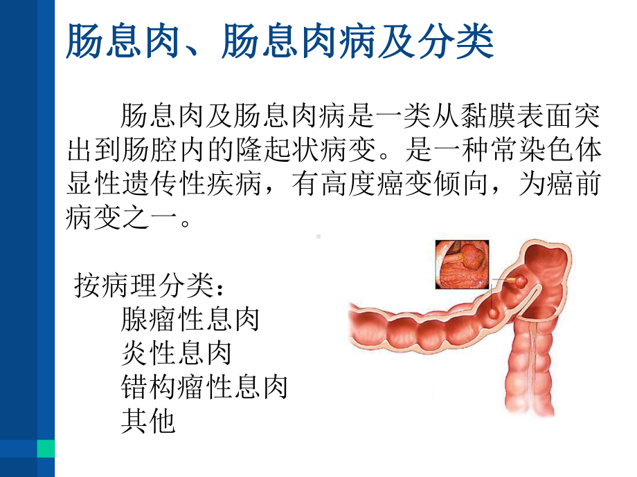 (推荐下载)家族性结肠息肉病教学课件.ppt_第2页