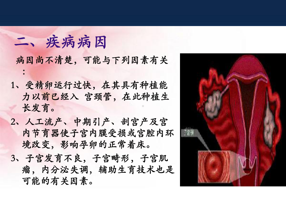 (医学)宫颈妊娠业务学习教学课件.ppt_第3页