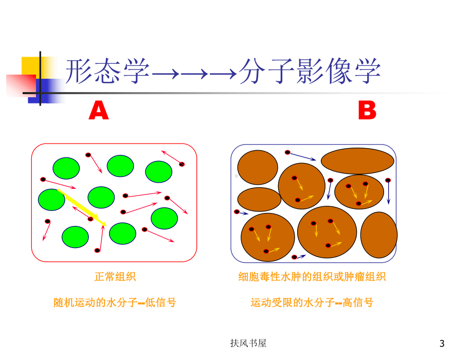 磁共振DWI的应用[业界优制]课件.ppt_第3页