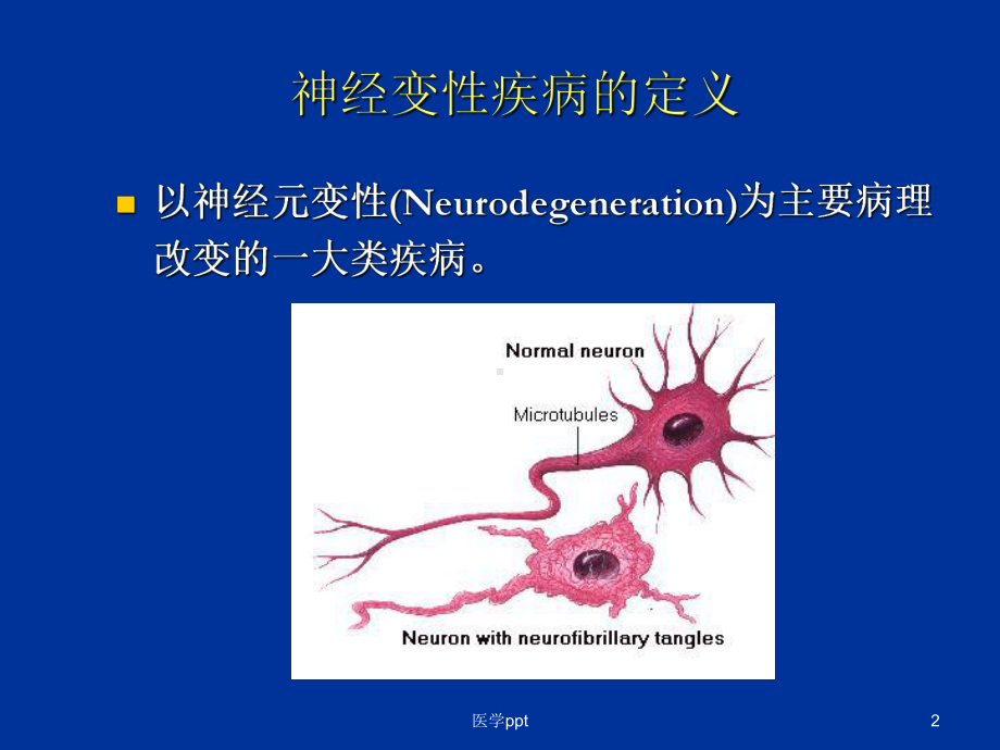 帕金森病诊断(陈生弟课件.ppt_第2页