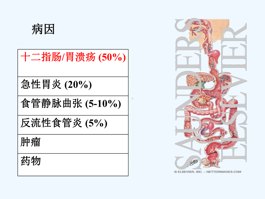 消化道出血观察及护理课件.ppt_第3页