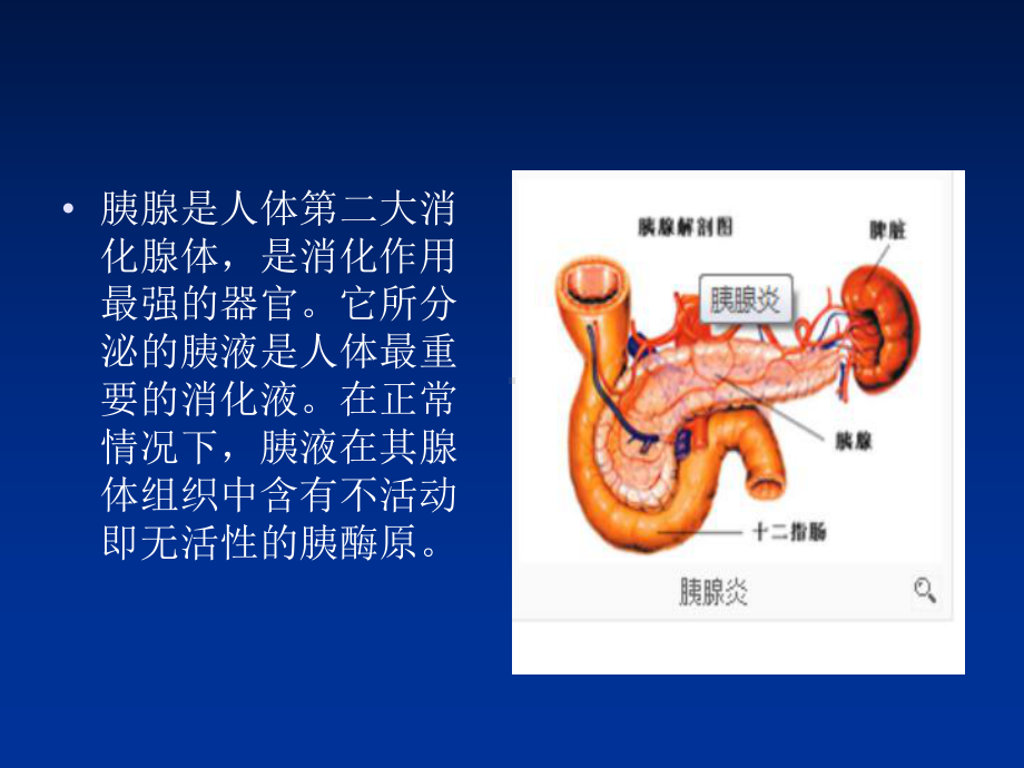 最新6月急性胰腺炎的护理汇总课件.ppt_第2页