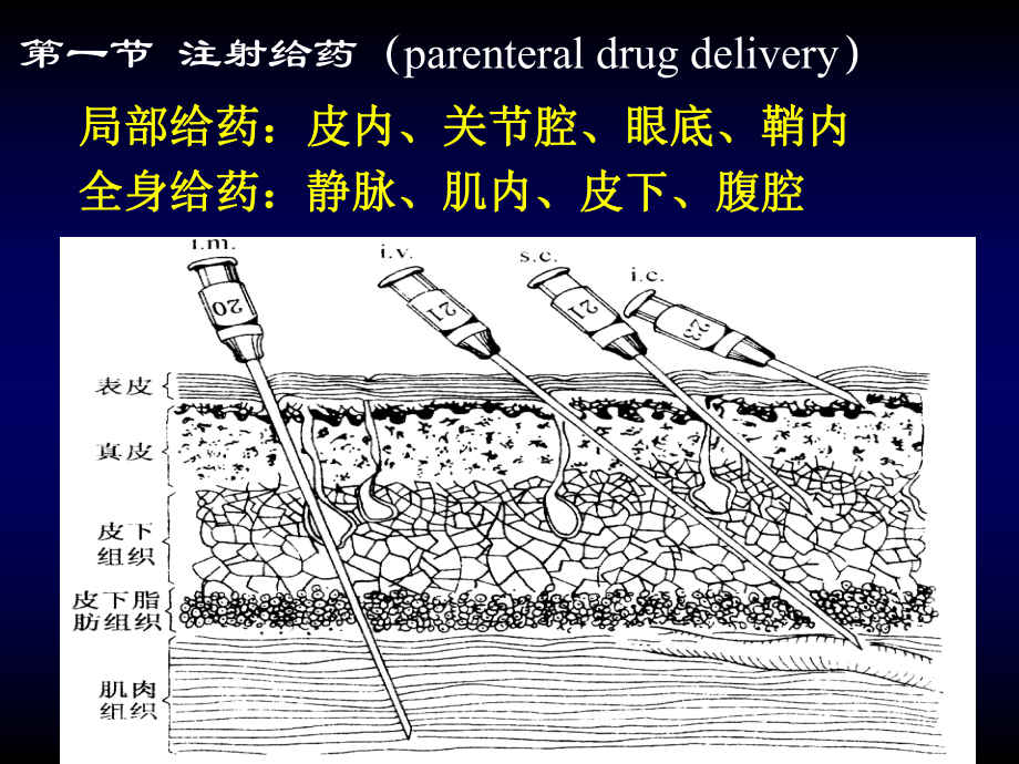 给药部位与吸收途径静脉注射课件.ppt_第3页