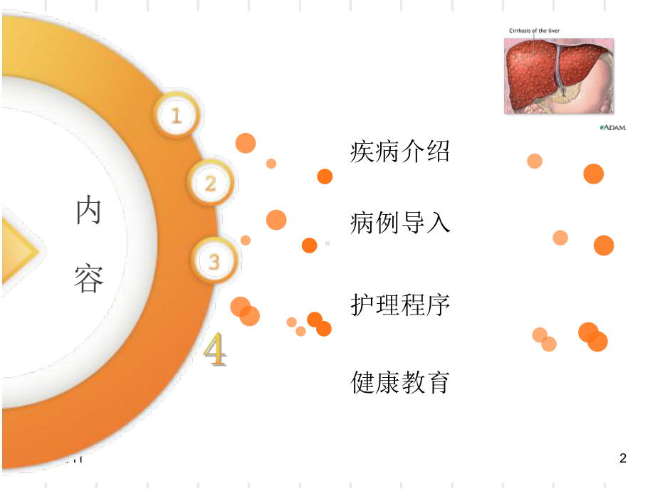 肝硬化病人的护理查房-课件.ppt_第2页