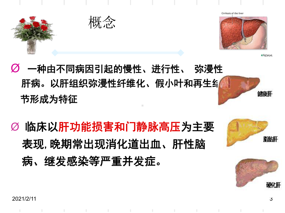 肝硬化病人的护理查房-课件.ppt_第3页