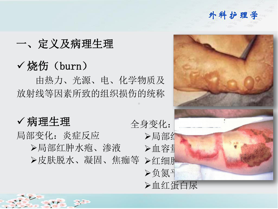 烧伤的预防与护理课件.ppt_第3页