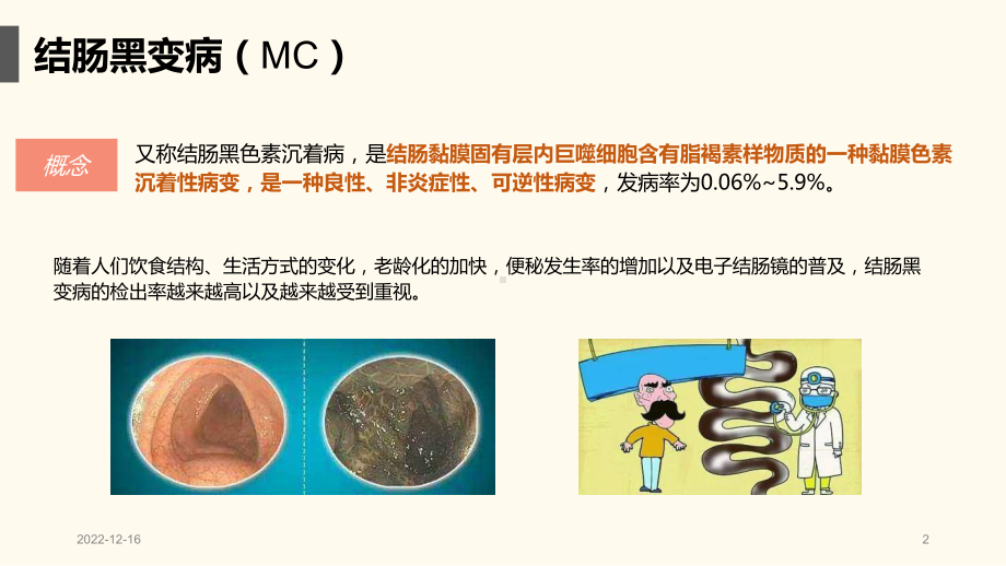 结肠黑变病参考课件.ppt_第2页