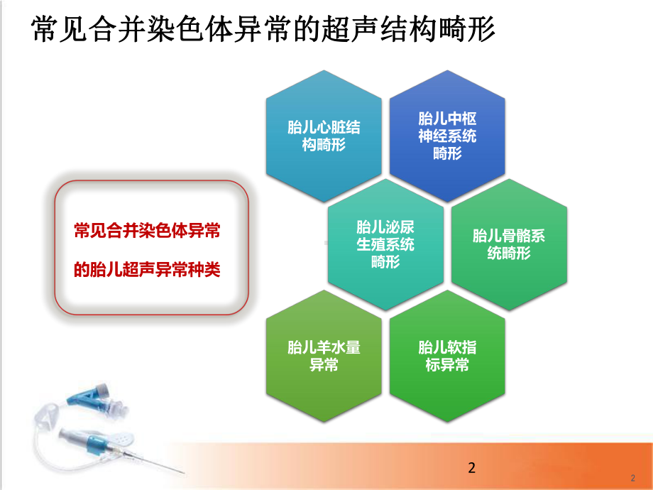 医学课件-胎儿超声结构异常的遗传学诊断教学课件.pptx_第2页