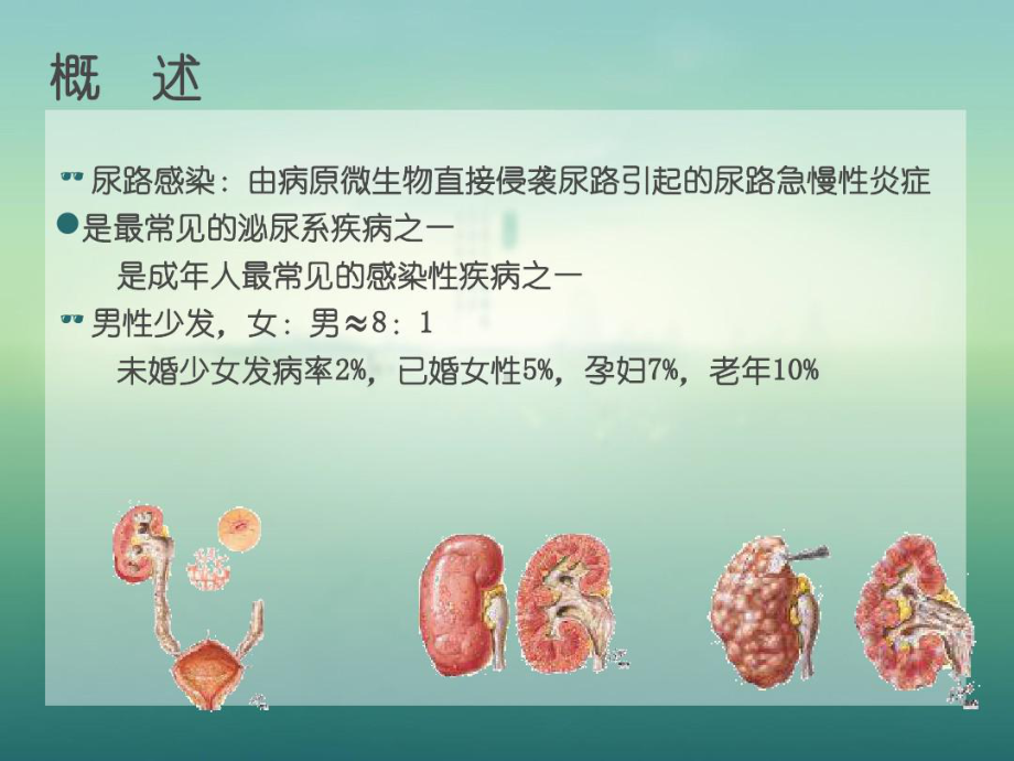 尿路感染患者健康教育课件.ppt_第3页