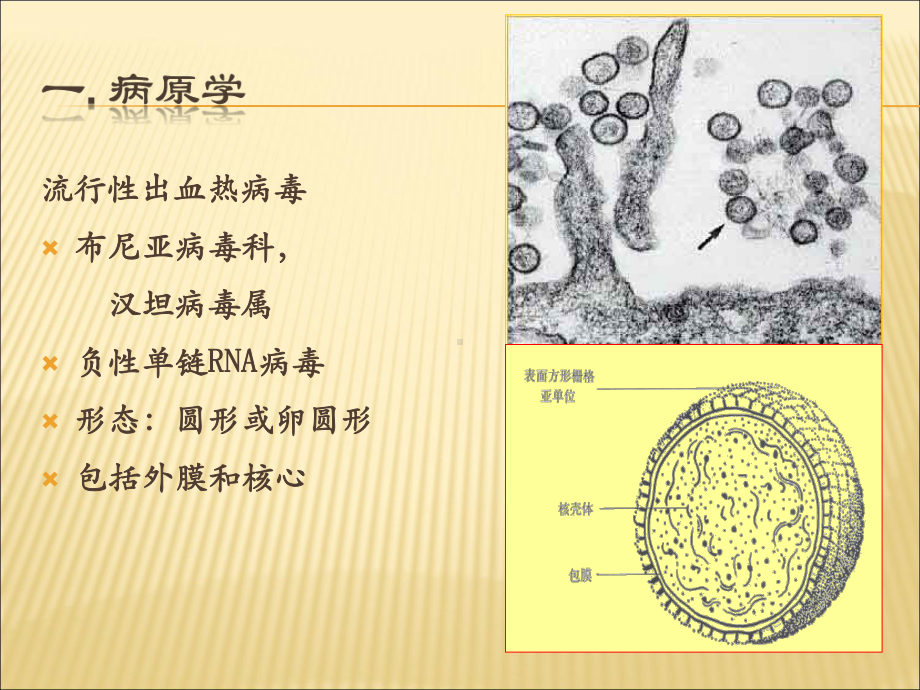 内科流行性出血热教学课件.ppt_第3页