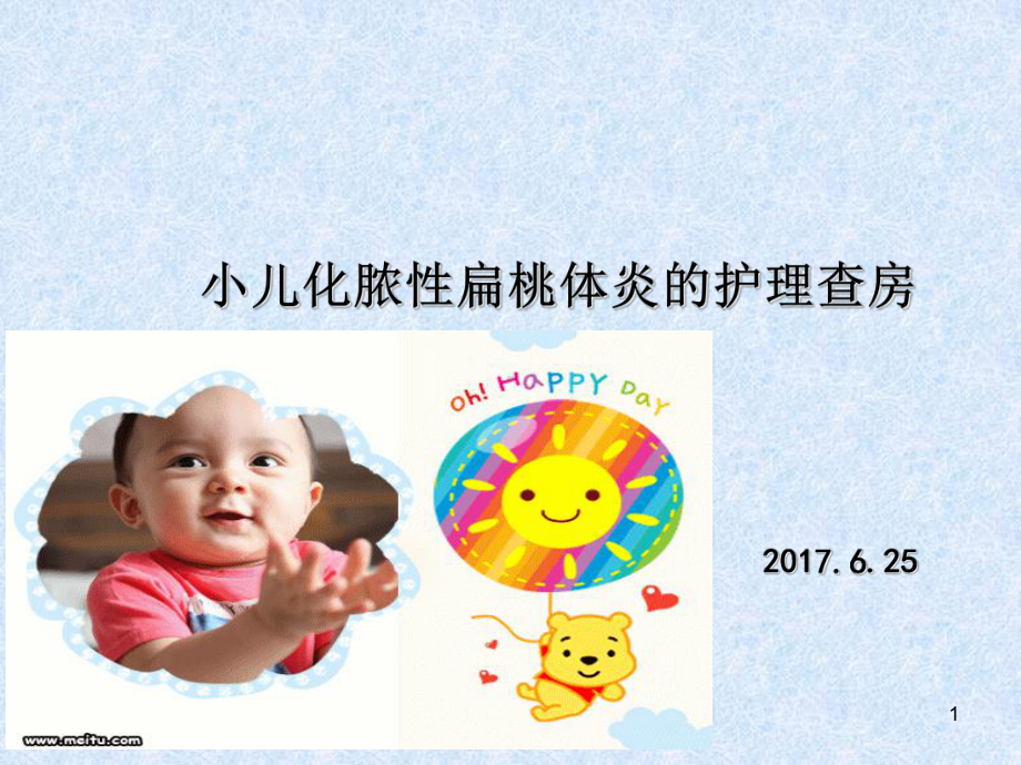 小儿化脓性扁桃体炎-(课堂)课件.ppt_第1页